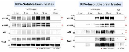 SDS-PAGE 분석을 이용한 TauP301L-BiFC 생쥐의 타우 단백질의 인산화 및 응집 확인