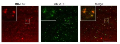 타우질환 마우스 모델 (MAPT*P301L)의 뇌 조직에서 선별된 프로브 BD-tau의 타우 응집체 표지 이미지