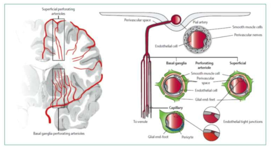 뇌동맥의 위치에 따른 분류와 모양