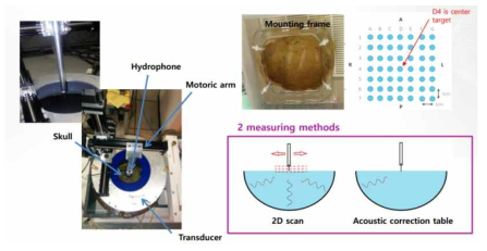 임상 장비를 이용한 Human cadaver skull 측정 시스템