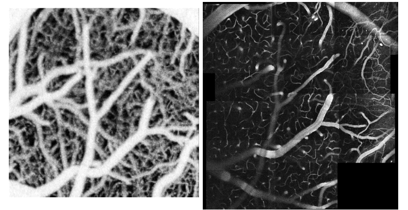 초고속 OCT angiogram과 이광자현미경 이미지의 비교검증