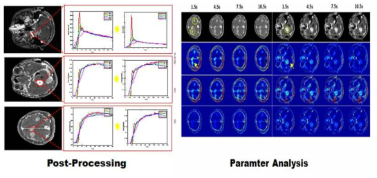 시공간 해상도 변화에 따른 혈액뇌장벽 누출 패러미터 (Ktrans) 추정 과정 및 정량화 영상