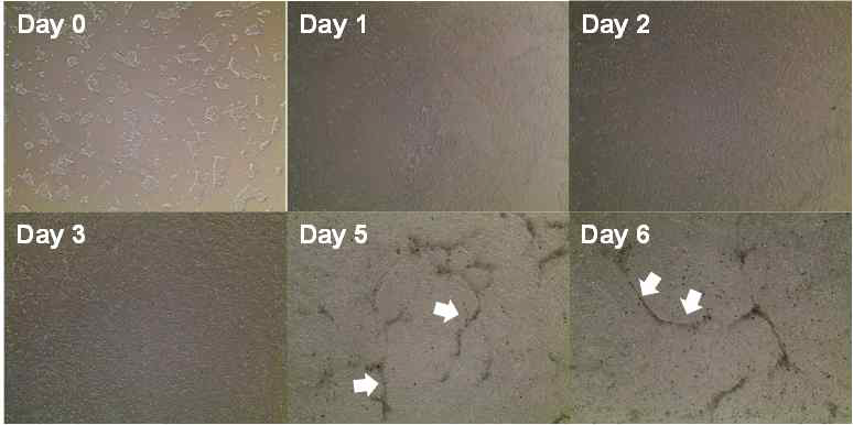 역분화줄기세포(day 0)가 unconditioned media (UM)에서 배양되면서, endothelial progenitor와 neural progenitor (화살표)로 같이 분화되어 가기 시작함