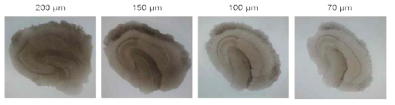 해마 뇌조직 두께에 따른 조직 이미지