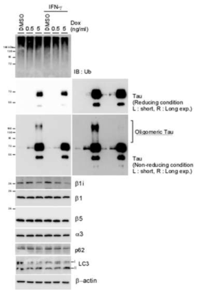 Doxycyclin(Dox)의 처리 농도를 증가시킬수록 타우의 발현이 증가되는 세포주(293-TREX-Tau)에서 타우의 응집이 생성되는 농도와 같은 조건에서 IFN -gamma를 처리한 결과 타우단백질의 응집형성이 억제되었음을 확인