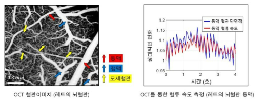 OCT를 이용한 Rat 의 angiogram과 혈류 속도 측정 결과