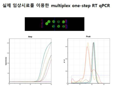 실제 임상시료를 이용한 multiplex one-step RT qPCR