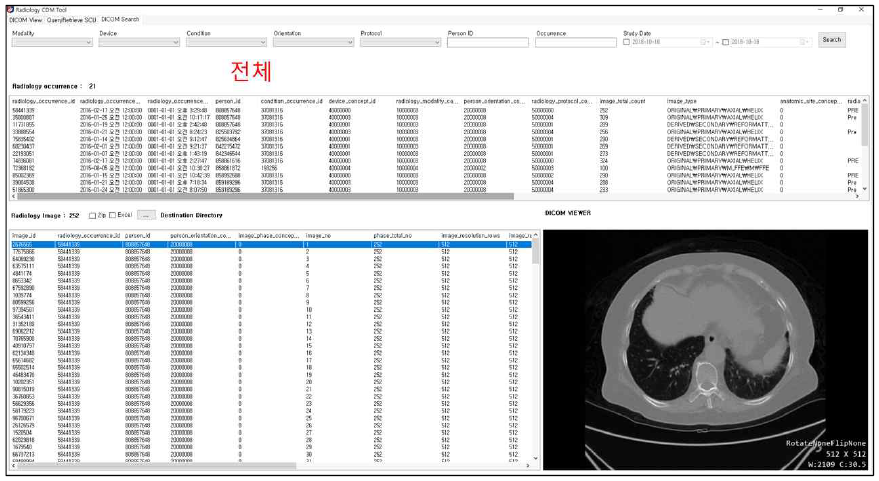 Radiology CDM Tool을 이용하여 의료영상데이터 정보 검색 및 확인
