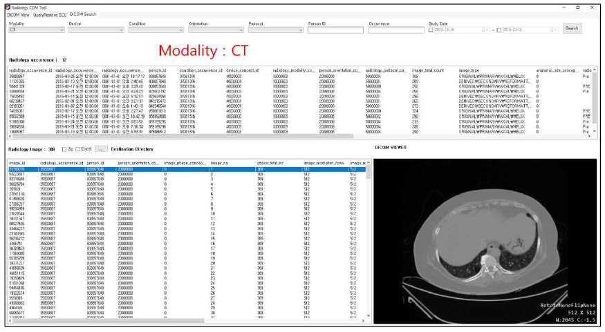 DB 검색 예시: 영상장비(Modality) = 전산화 단층촬영 장비(CT)