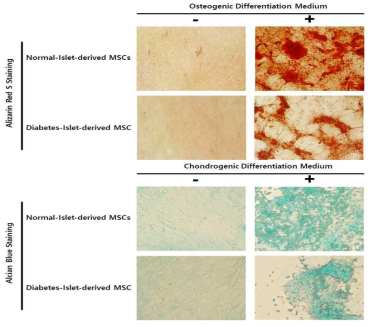 정상인 세포와 당뇨병 세포(췌도 유래 중간엽줄기세포)의 멀티리니지 분화 비교
