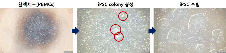 혈액세포(PBMCs)의 유도만능줄기세포 유도 과정