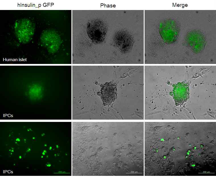인슐린 프로모터 GFP의 발현을 통한 인슐린 생성 세포의 확인