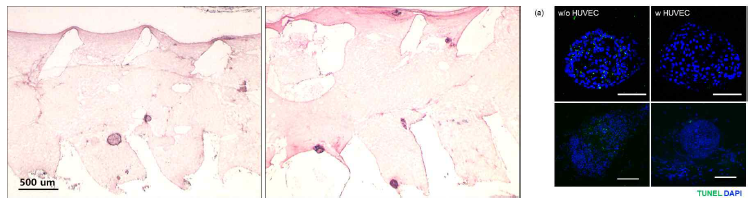 혈관화 세포주가 췌도 세포에 미치는 영향 확인. 인간 탯줄 정맥 내피 세포(HUVEC)를 함께 봉입하지 않은 실험군에서 더 많은 세포 사멸 확인