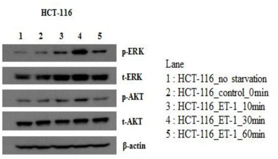 ET-1 처리에 따른 HCT-116 암세포주의 ERK, AKT의 phosphorylation 실험 결과