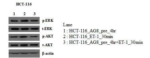 ET-1과 AG8 항체 처리에 따른 HCT-116 암세포주의 ERK, AKT의 phosphorylation 실험 결과