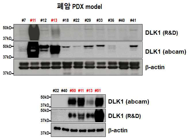 폐암 PDX model 13 케이스에서 DLK1 발현 여부