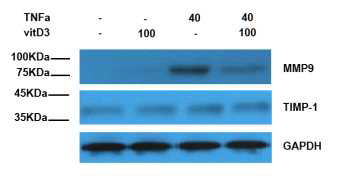 TNF-α와 TIMP-1의 MMP-9의 발현