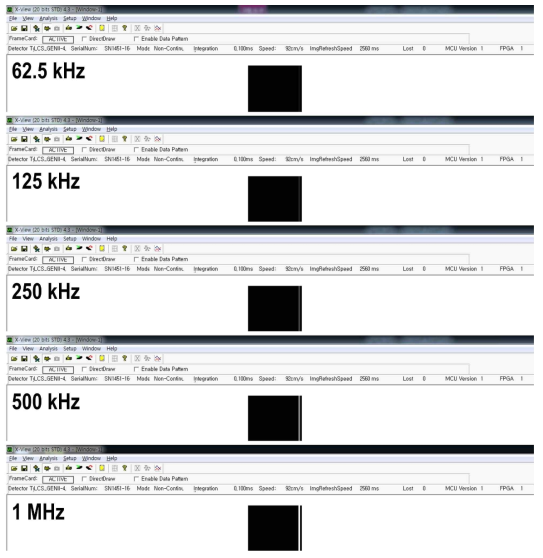 Detection Technology사의 영상 획득 소프트웨어를 사용하여 캡처한 각 주기 (62.5 kHz, 125 kHz, 250 kHz, 500 kHz, 1 Mhz)에 따른 영상