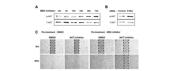 Ras-ERK pathway를 억제할 경우 PI3K-AKT 시그널링의 재활성화가 세포의 이동성에 미치는 영향 분석