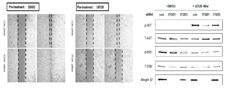 Ras-ERK 시그널링 억제약물과 Integrin beta1과의 상호작용