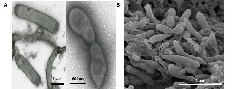 Cell morphology of strain KGMB01110T. Cells were analyzed using transmission electron microscope (A) and scanning electron microscope (B)
