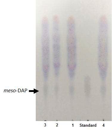 The peptidoglycan of the cell walls of strain KGMB01110T and reference strains contained meso-diaminopimelic acid (meso-DAP) as the diagnostic diamino acid