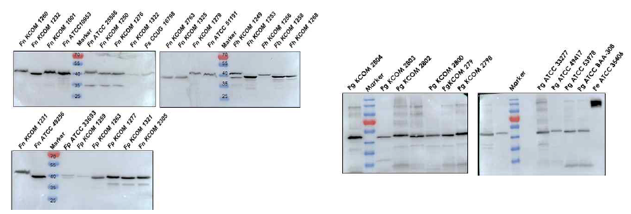 Immunoblot analysis (A) Fusobacterium 임상 분리 균주 분석. (B) P. gingivalis 임상 분리 균주 분석