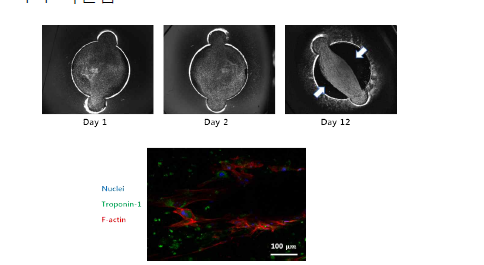 광학현미경을 통한 표면개질 디바이스에서의 심근세포 / 섬유모세포 / 콜라겐 복합체의 형상 모니터링 및 면역염색 후 형광촬영 이미지