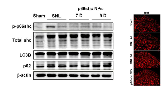 Protein level of the autophagy related factors and p66shc were identified in SNL model. & Formation of mitochondrial ROX after p66chc NP indection in SNL model