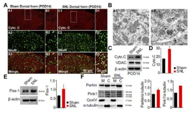 Pink1 with mitophagy and mitochondria dynamics