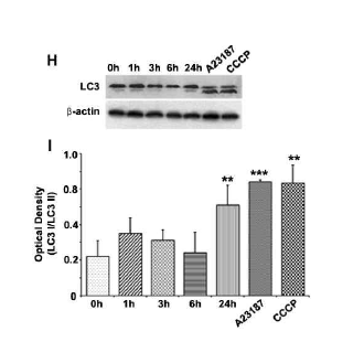 LC3 expression in neuronal cell with microglia CM treatment