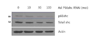 adenop66shcRNAi vector