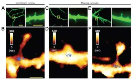 돌기 구조 유형별 miR-134 분포 관찰. (A) 형광 표지 된 수상돌기의 저배율 현미경사진(왼쪽)과 그중 선택적으로 관찰한 미성숙 돌기구조 대표 사진(왼쪽 그림 노랑색 정사각형부위, 고배율 사진 오른쪽). (B) 선택된 미성숙 돌기 구조의 AFM 이미지와 miR-134 클러스터가 인식된 위치(파랑색 동그라미)를 표시함. (C와 E)형광 표지 된 수상돌기의 저배율 현미경사진(왼쪽)과 그중 선택적으로 관찰한 성숙한 돌기구조(C: stubby 유형, E: mushroom 유형) 대표 사진(왼쪽 그림 노랑색 정사각형부위, 고배율 사진 오른쪽). (D와 F) 선택된 각각의 성숙 돌기 구조(D: stubby, F: mushroom)의 AFM 이미지와 miR-134 클러스터가 인식된 위치(파랑색 동그라미)를 표시함