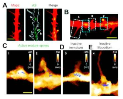활성 표지된 위치의 돌기 구조에서의 miR-134 관찰. (A) 형광 표지된 수상돌기의 일부(왼쪽사진)와 형광 표지자로 활성 표지된 위치(가운데 사진)를 겹친 사진(오른쪽 사진). 이 중 활성이 표지된 돌출 구조체를 흰색 화살표로 표시함 (가운데 사진). (B) A에서 활성 돌기 구조체와 비활성 돌기 구조체를 형태학적 분류방법에 따라 성숙 돌기(파랑색 점선 사각형)과 미성숙 (흰색 점선 사각형)으로 구분 (C) B에서 분류한 위치에서 성숙 돌기(1: 스터비, 2: 머쉬룸)에서 AFM 이미징으로 miR-134 클러스터 관찰. (D) B에서 분류한 위치에서 미성숙 돌기(3: 씬)에서 AFM 이미징으로 miR-134 클러스터 관찰. (E) B에서 분류한 위치에서 미성숙 구조 체(4: 필로포디움)에서 AFM 이미징으로 miR-134 클러스터 관찰