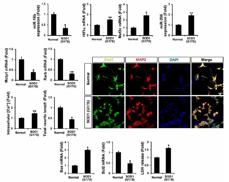 fALS derived motor neuron에서의 새로운 세포사멸 기전