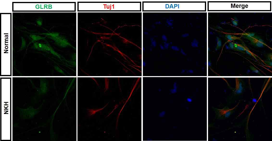 GLRB staining in NKH cortical neuron