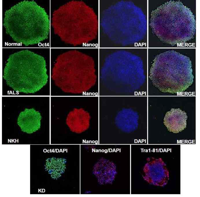 Normal familial ALS, Kennedy’s disease & NKH 환자로부터 iPSC를 유도하고 iPSCs마커를 이용하여 확인