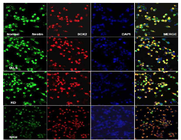 Normal, fALS, KD and NKH의 NSCS를 분화 마커를 통해 확인