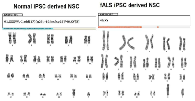 Normal and fALS NSCs의 karyotype analysis