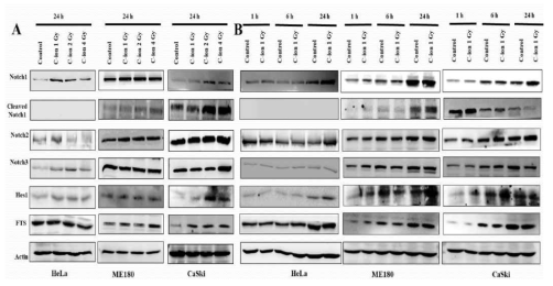 C-12 이온 빔 (1, 2, 4 Gy)에 의한 Notch1, 2, 3, Hes1 및 FTS 단백질의 발현 증가