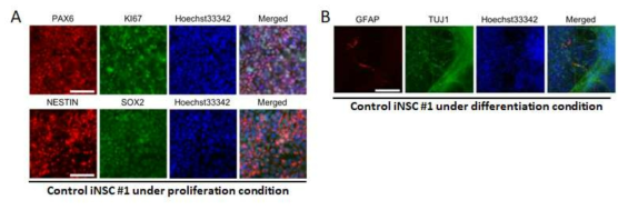 Control iNSC #01 ICC under proliferation and differentiation condition