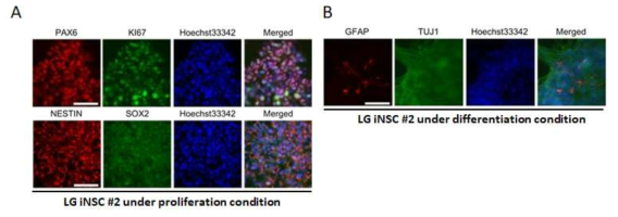 LG iNSC #02 ICC under proliferation and differentiation condition