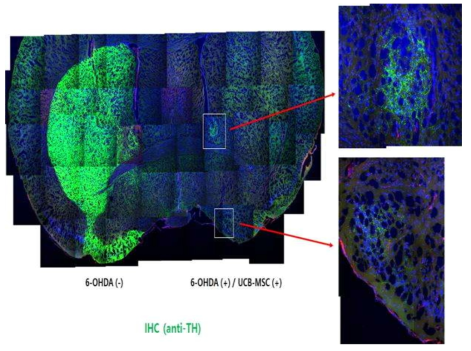 UCB-MSC에 의한 dopaminergic neuron의 regenration 효과 (Unpublished data)