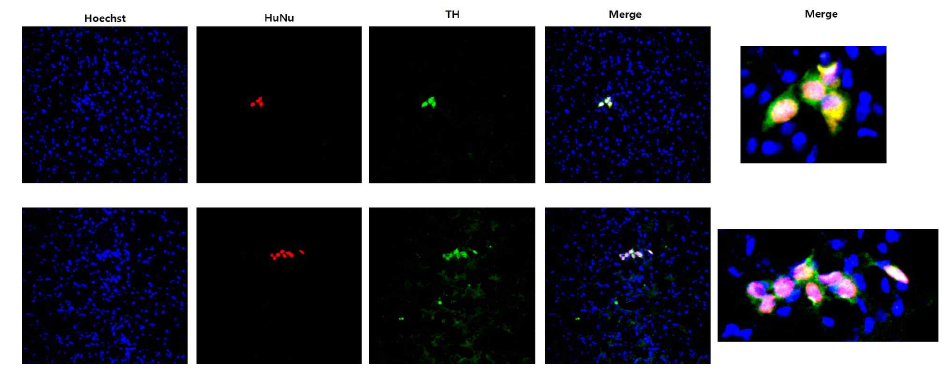 dcNSC의 in vivo dopaminergic neuron 분화 및 생존 확인 (Unpublished data)