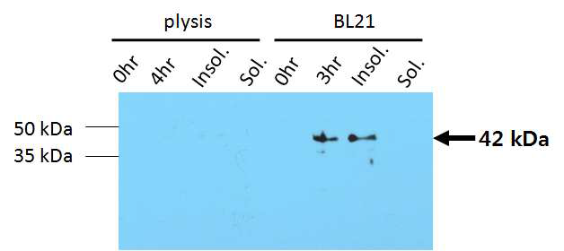 Western blotting을 통한 ZIKV NS1 단백질의 발현