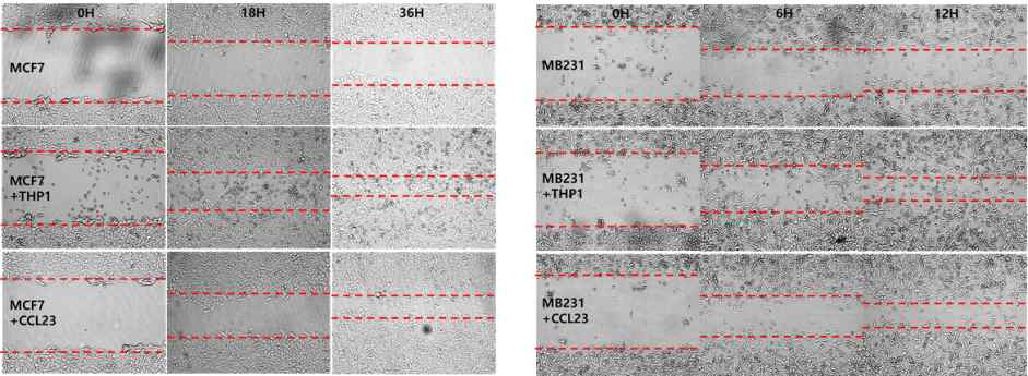 wound healing assay