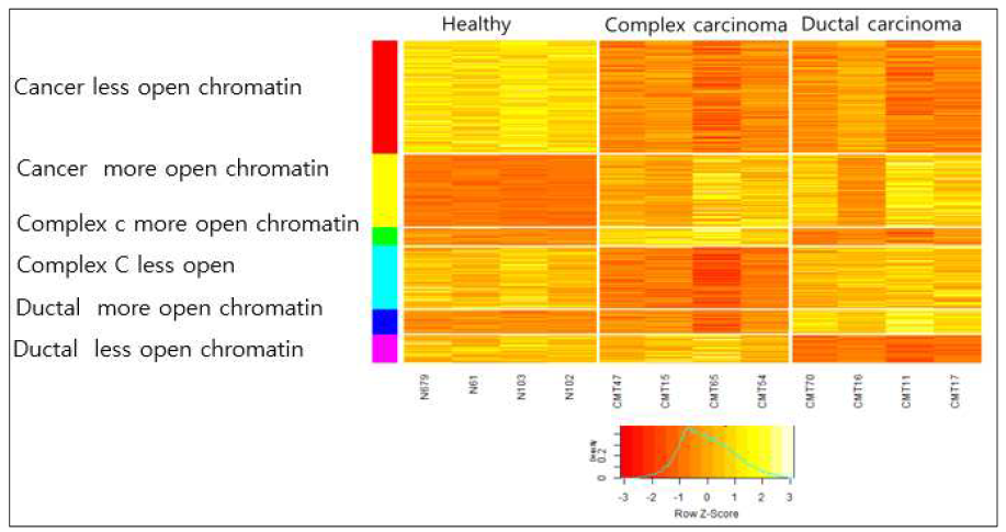 complex carcinoma와 ductal carcinoma에서 특이적으로 변화하는 오픈 크로마틴