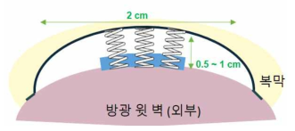 센서 크기 및 방광의 적용 위치