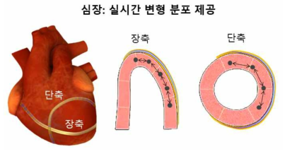 심장의 장축단면도(좌)와 단축단면도(우) 및 센서를 외벽에 부착한 모식도