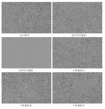 48시간 후 세포 관찰 사진